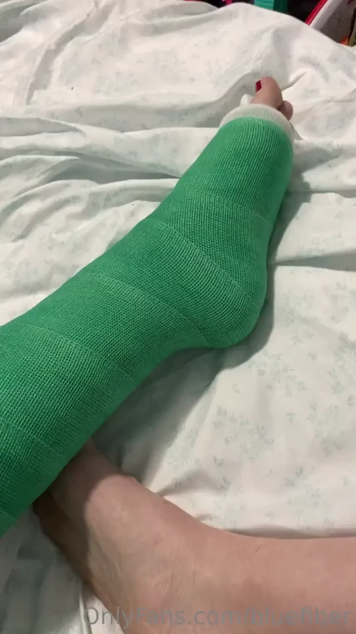 This cast was so hard to move in i wouldn t have been able to get 