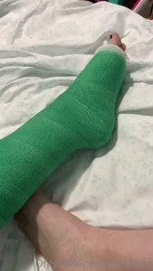 This cast was so hard to move in i wouldn t have been able to get