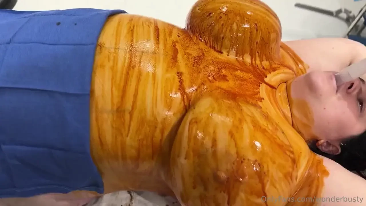 This video is from during surgery i m very swollen and covered in 