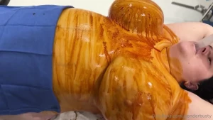 This video is from during surgery i m very swollen and covered in