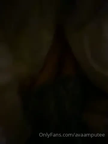 It s stormy out and i have phantom pain 