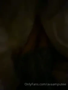 It s stormy out and i have phantom pain