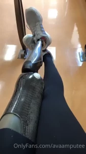 Hello from my prosthesis appointment i am getting a new socket