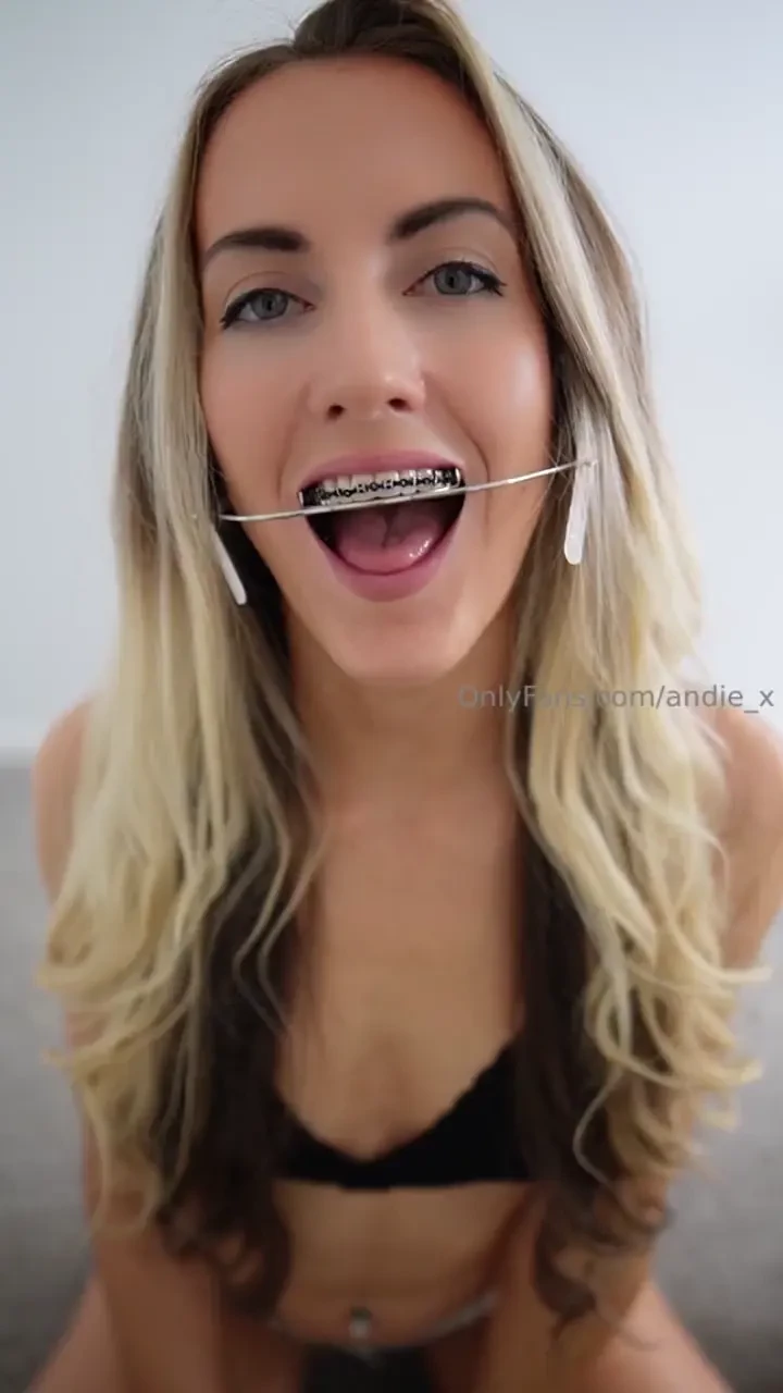 Oops i almost forgot to send out this sexy little braces q amp a mouth part 1 