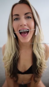 Oops i almost forgot to send out this sexy little braces q amp a mouth part 1