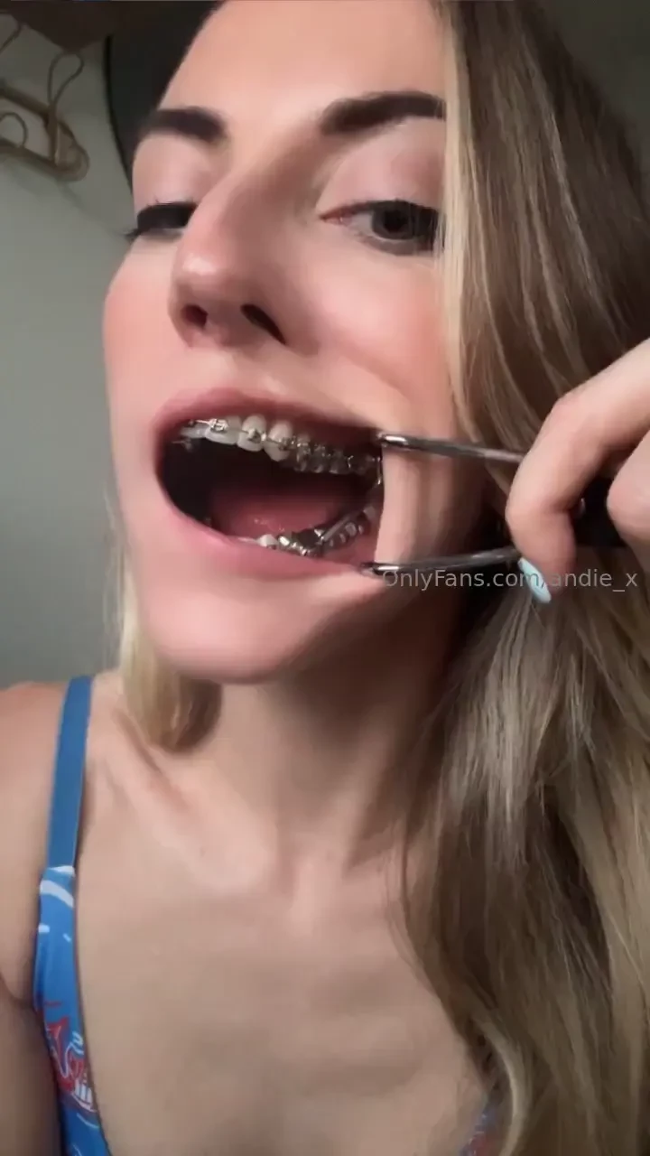 Hey guys i m sickly today with a fever and a stomach bug but here s a 