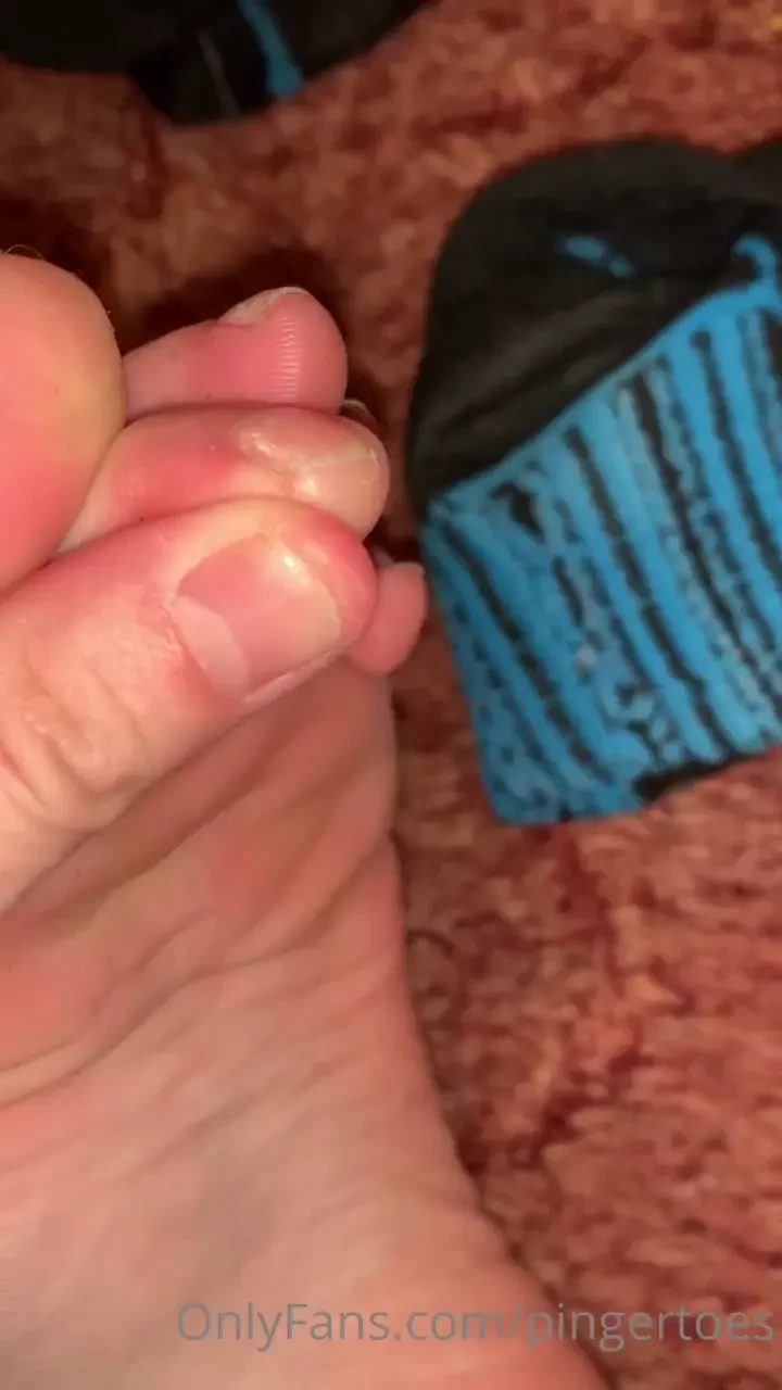 Nasty stinky i wouldn t recommend gels on toes and if you wonder why 