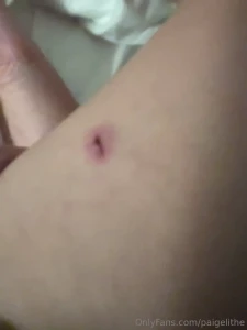 I got bite last night but the guy doing a tickling session idk anymore