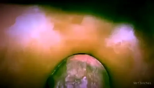 Part one and two part 1 