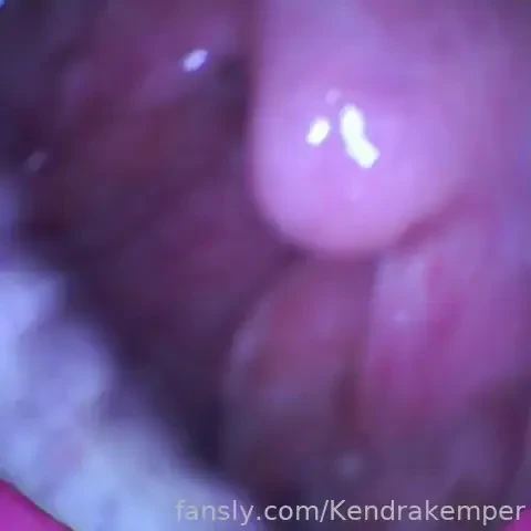 Swallowed never to be seen again uvula endoscopy vore endoscopycamera 