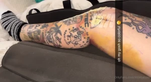 March 4th i finally had my knee surgery i ve been dealing with a lot