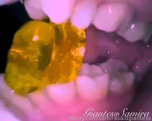 Gummy bears vore uvula dental saliva tongue drooling spitting uvula