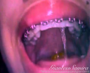 Gummy bears vore uvula dental saliva tongue drooling spitting uvula part 1
