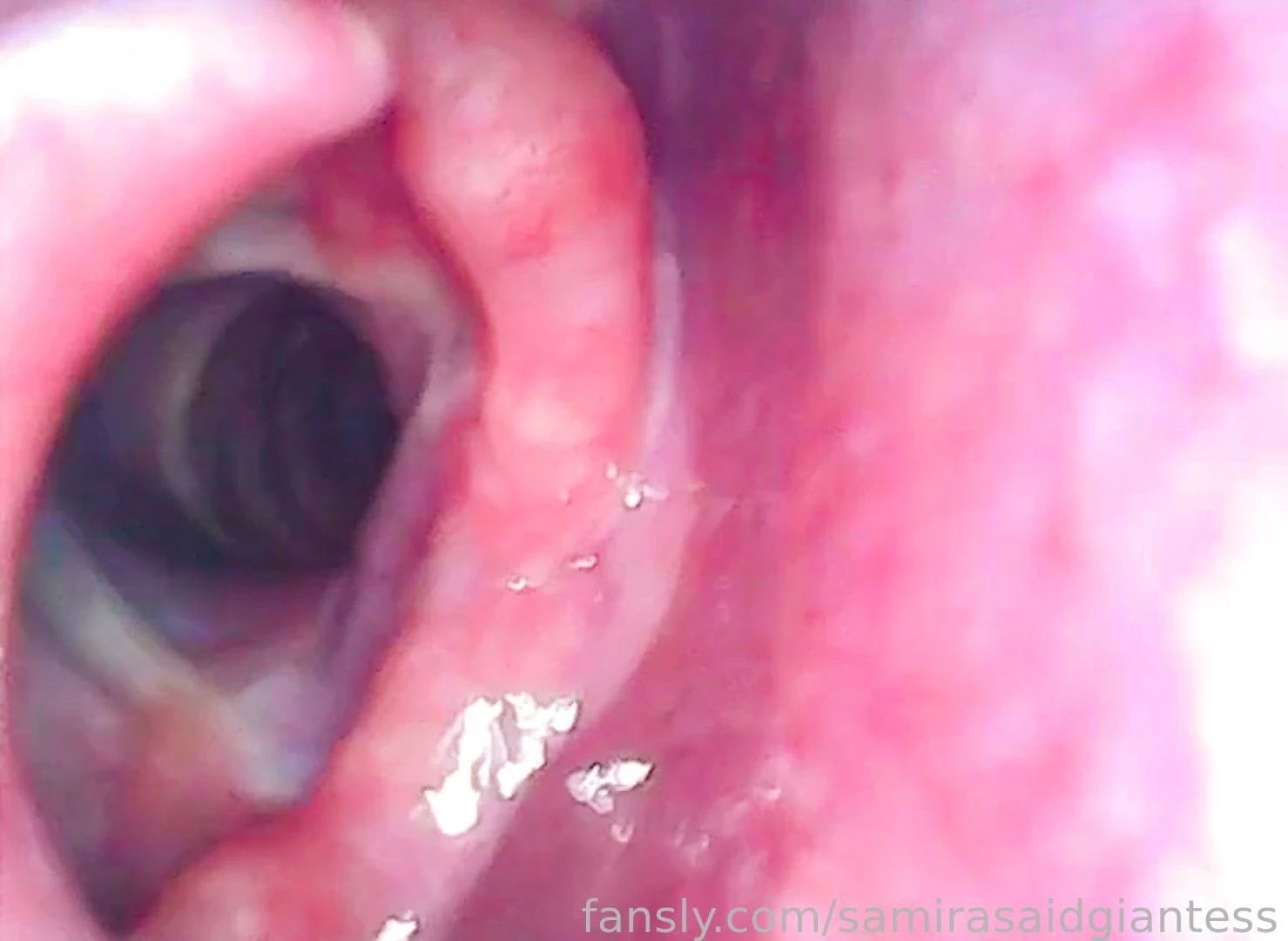 Do you want to see my epiglottis in action then order your custom 