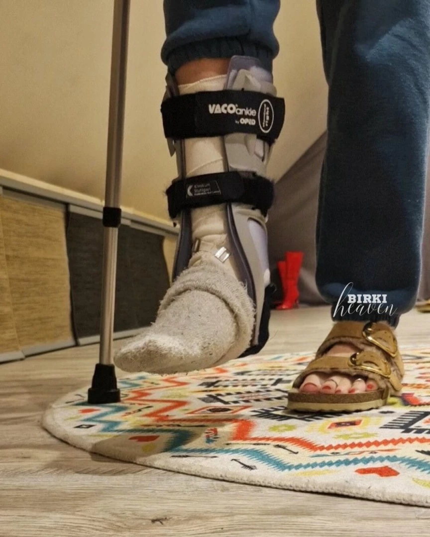 Ribbon ruptures are pain i tell you i could only put on a birkenstock 