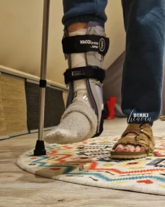 Ribbon ruptures are pain i tell you i could only put on a birkenstock