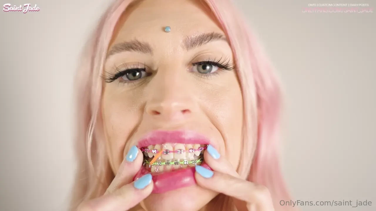 Calling all braces lovers this is for you tip 25 on this post for my 