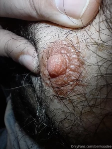 Hello my fans today some hairy tits some macro nipple pics and some part 4