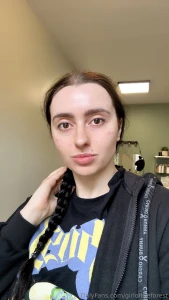 Guys i got facial injections i chose a product called poly-n strong it
