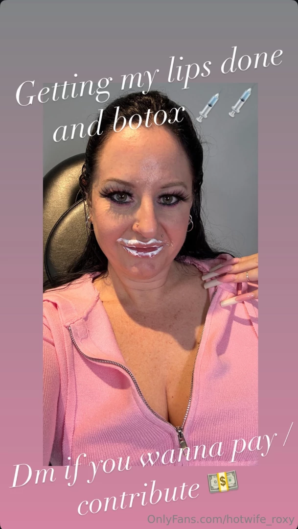Dm me if you wanna pay contribute for my lips and botox serious 