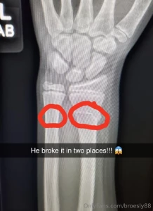 Offsprings will be the death of me fell wrong while skating