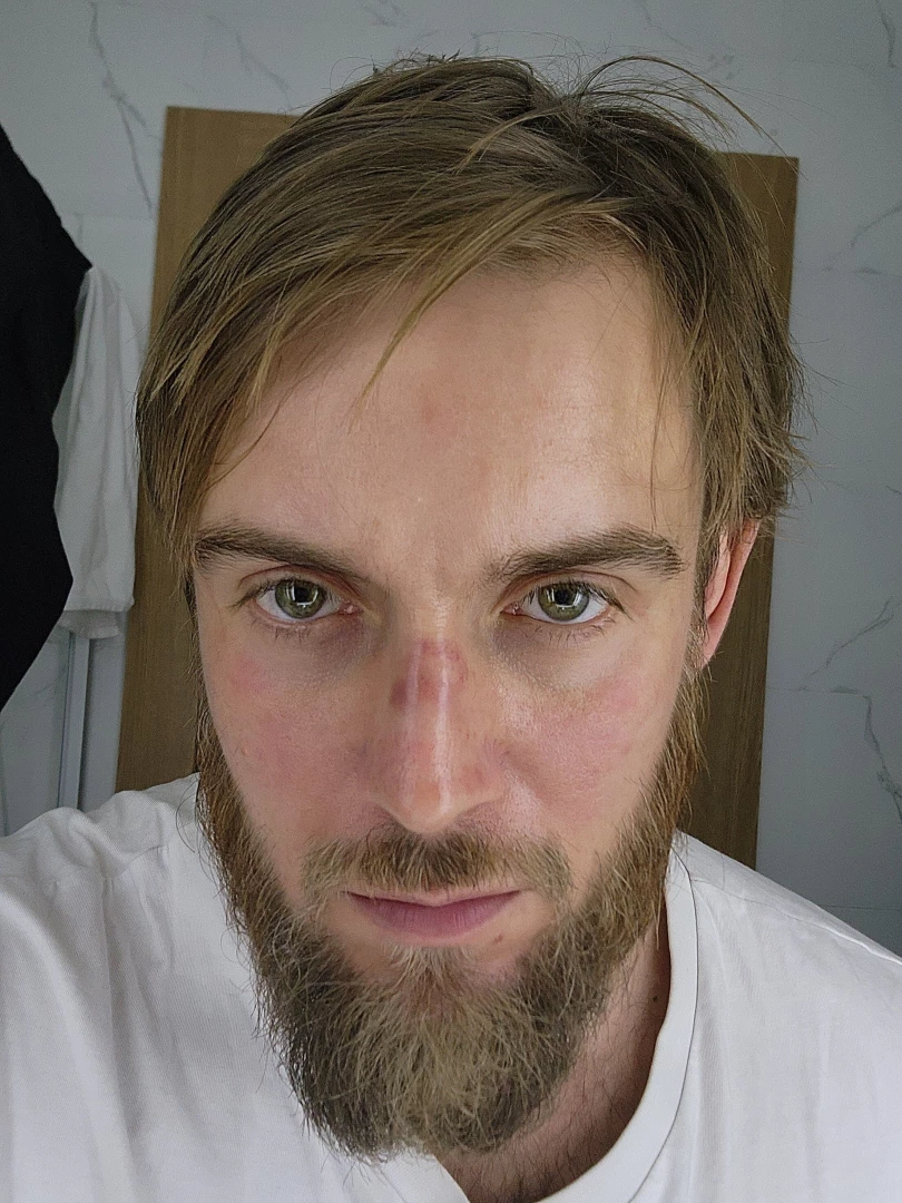 Ouch sparring with a guy full of ego who wanted to go 100 he deserved 