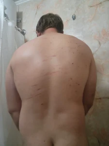 Look at my back haha crazy part 1