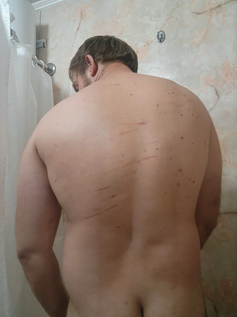 Look at my back haha crazy 