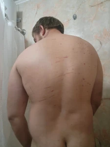 Look at my back haha crazy