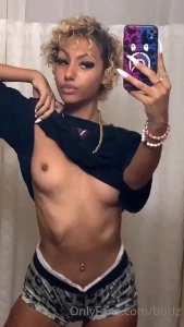 Would u still suck on my mosquito bites