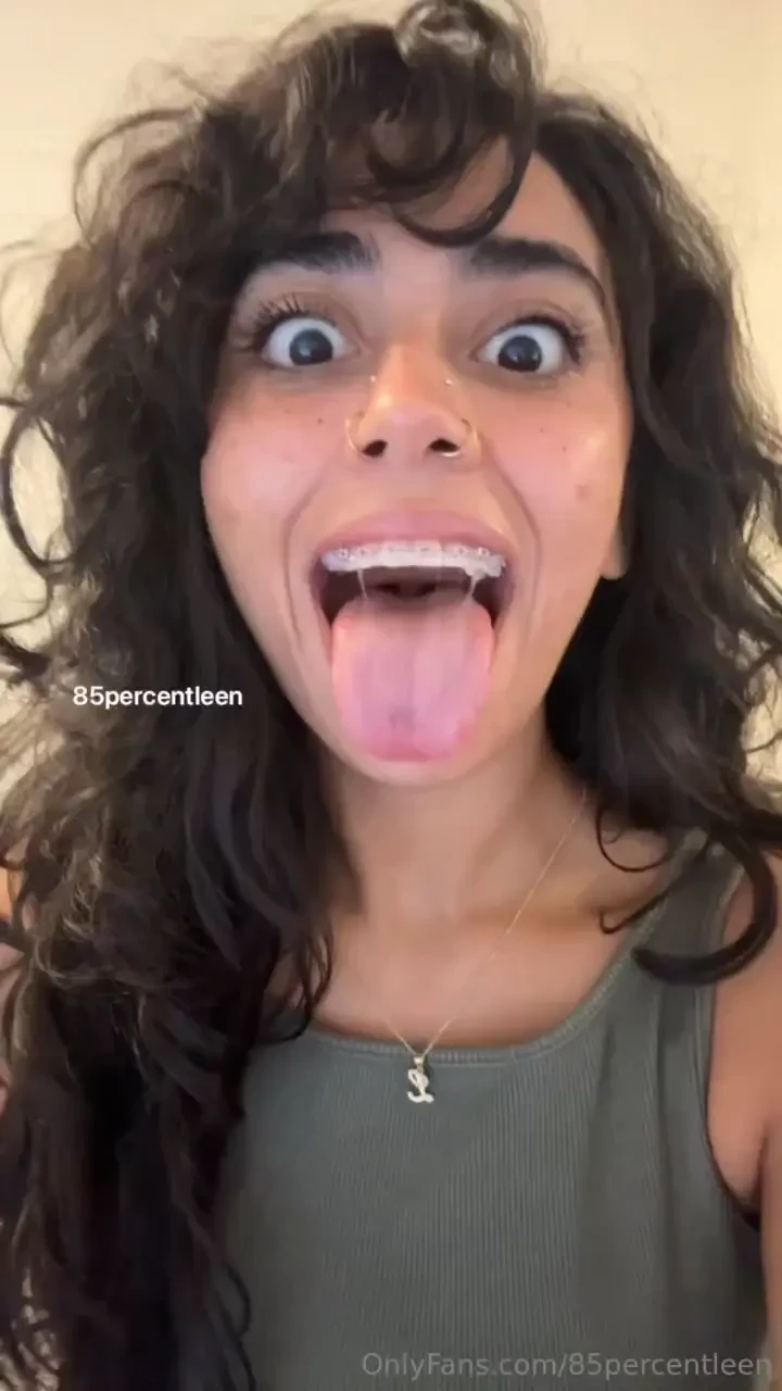 Ready for the reveal surprise i got braces ahhh better late then never 