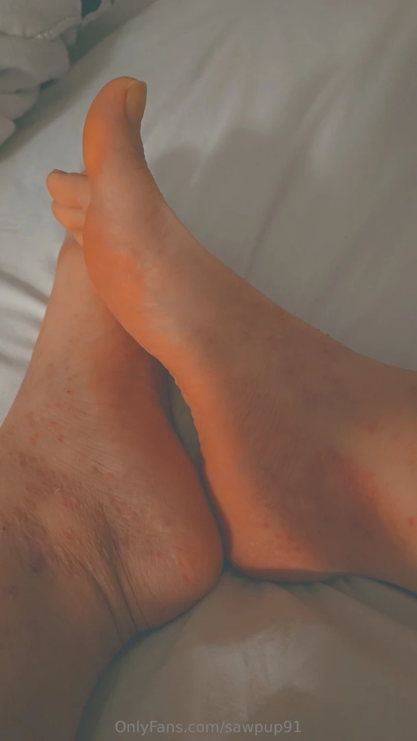 Feet and bit of bruises part 4 