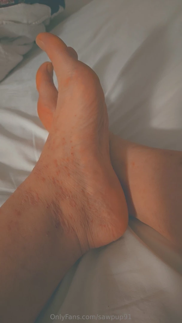 Feet and bit of bruises part 1 