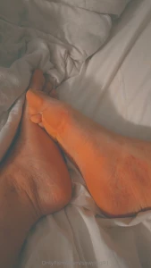 Feet and bit of bruises part 2