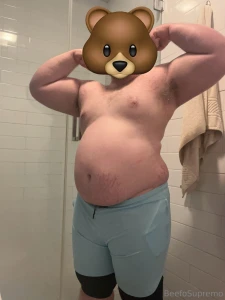 My stretch marks are going crazy part 1