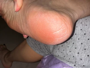 Omg my heels are so dry part 1