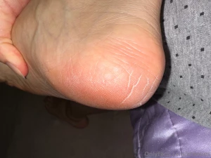 Omg my heels are so dry
