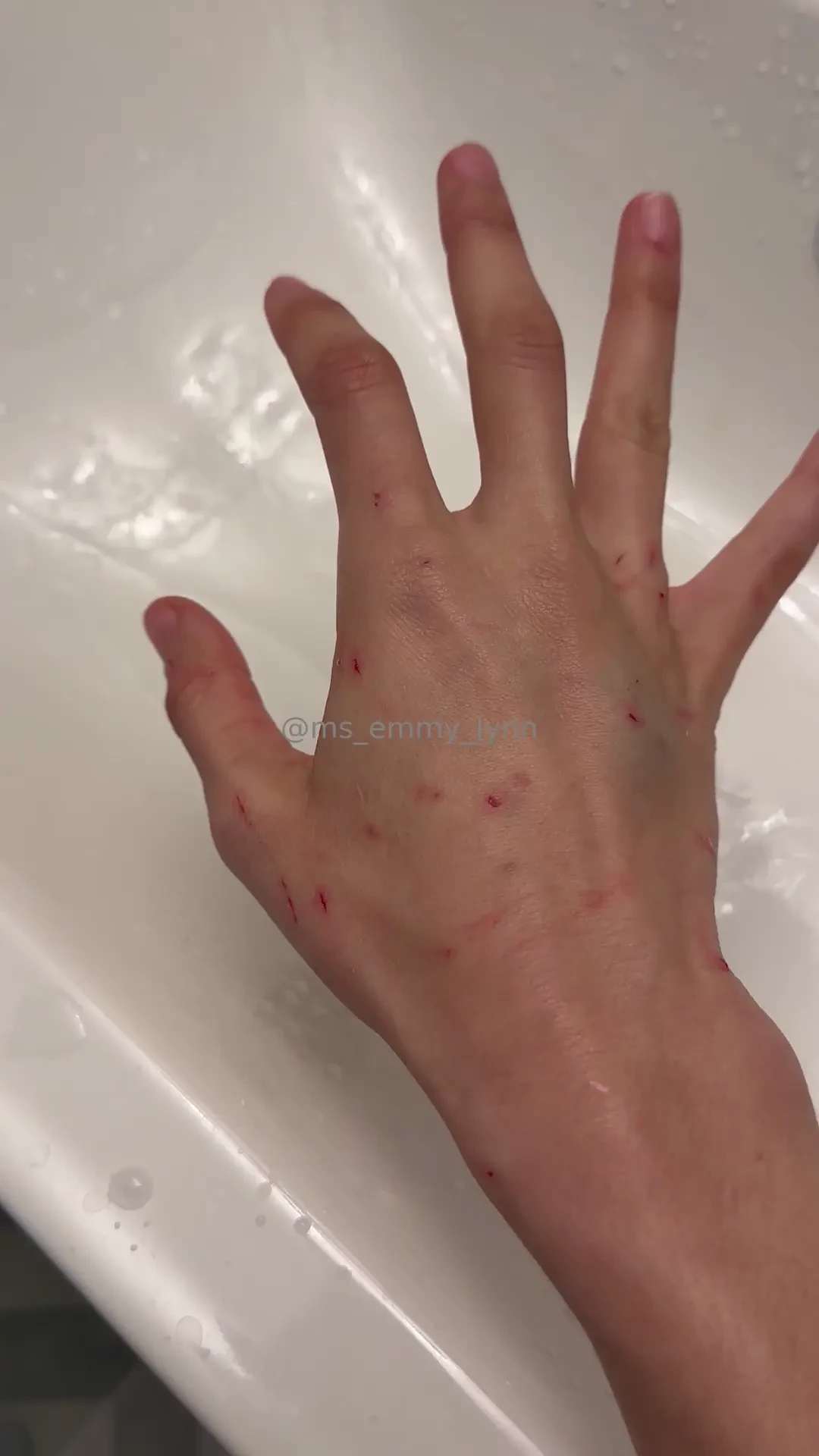 Outside time w augie turns gnarly my own fault for being distracted 