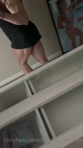 Ohh hey i spot a cupping mark be sure to like comment and message me