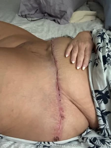 Loving the skin i m in flaws scars and all at 52 i embrace every part 4