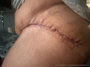 Loving the skin i m in flaws scars and all at 52 i embrace every part 1