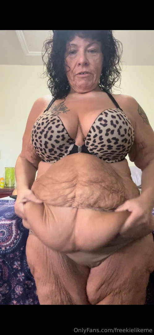 Loving the skin i m in flaws scars and all at 52 i embrace every part 5 