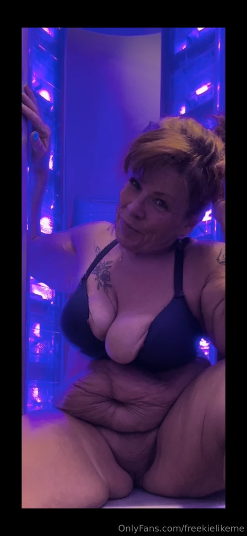 Loving the skin i m in flaws scars and all at 52 i embrace every part 9 