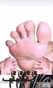 Soles or between the toes