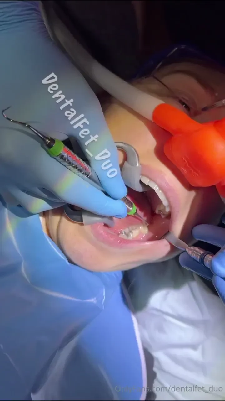 What would be your verdict on this do you think it s a cavity watch 
