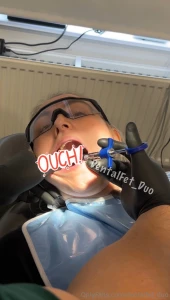 Sharp scratch at the back here amy behind your lower molars this will