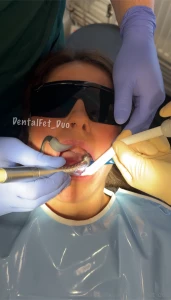 Kate s second ever filling assisted by her bestie amy