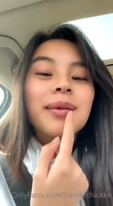 Just finished my little gum surgery here s an update you didn t ask