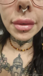 Numbing jabbing pouting bit of botox to myself too yay part 1