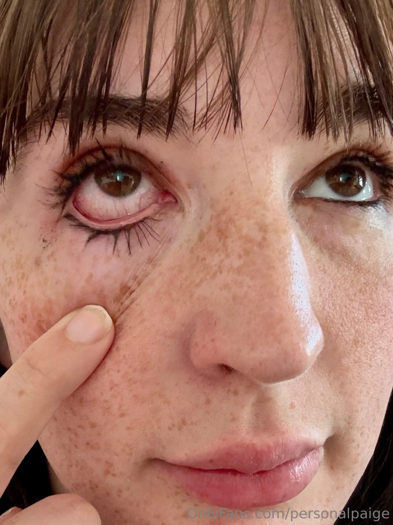 Halp i got the cums in my eye 